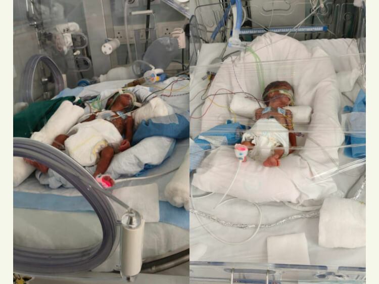 Baby of Mamta Mourya