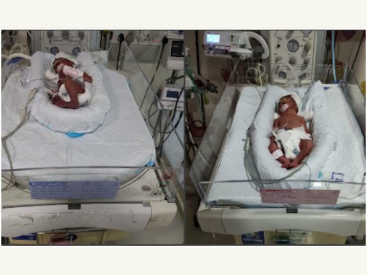 Baby of Sweta Roy Twins