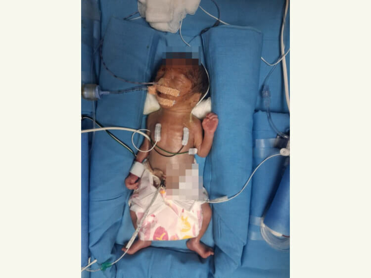 Baby of Vengala Swetha