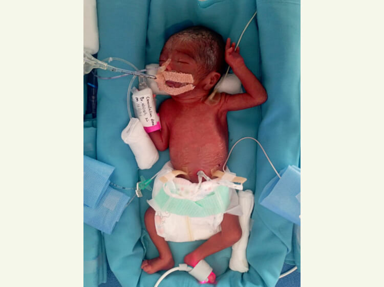 Baby Of Tejasree