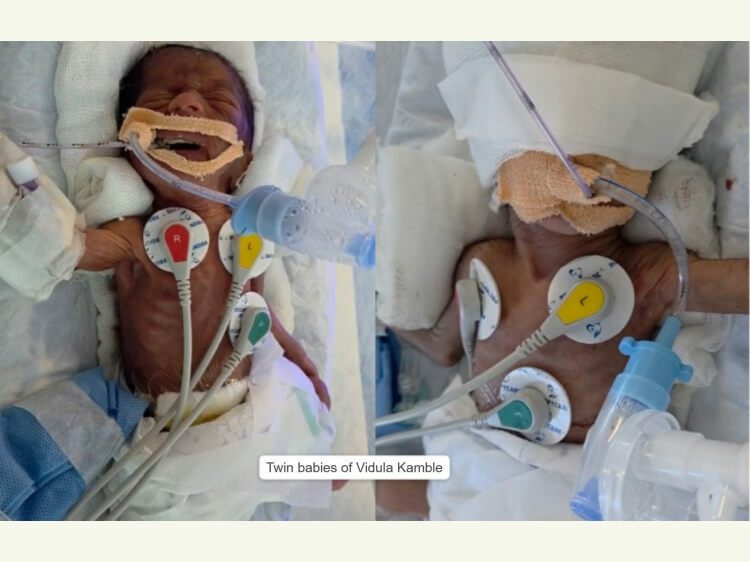 Twin babies of Vidula Kamble