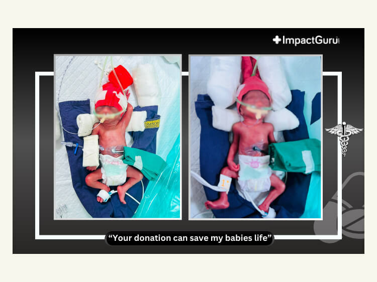 Twins Baby of Tanishka Gaonkar 