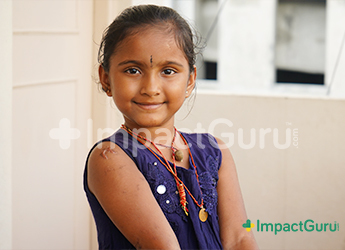1k+ Impact Guru donors became Nischithaâ€™s strength in PICU