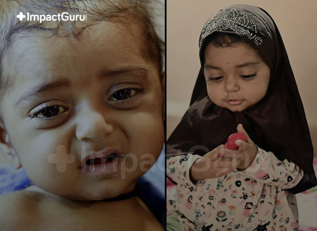 How 500+ Donors Came Together to Save a Tailor’s Daughter from Liver Failure