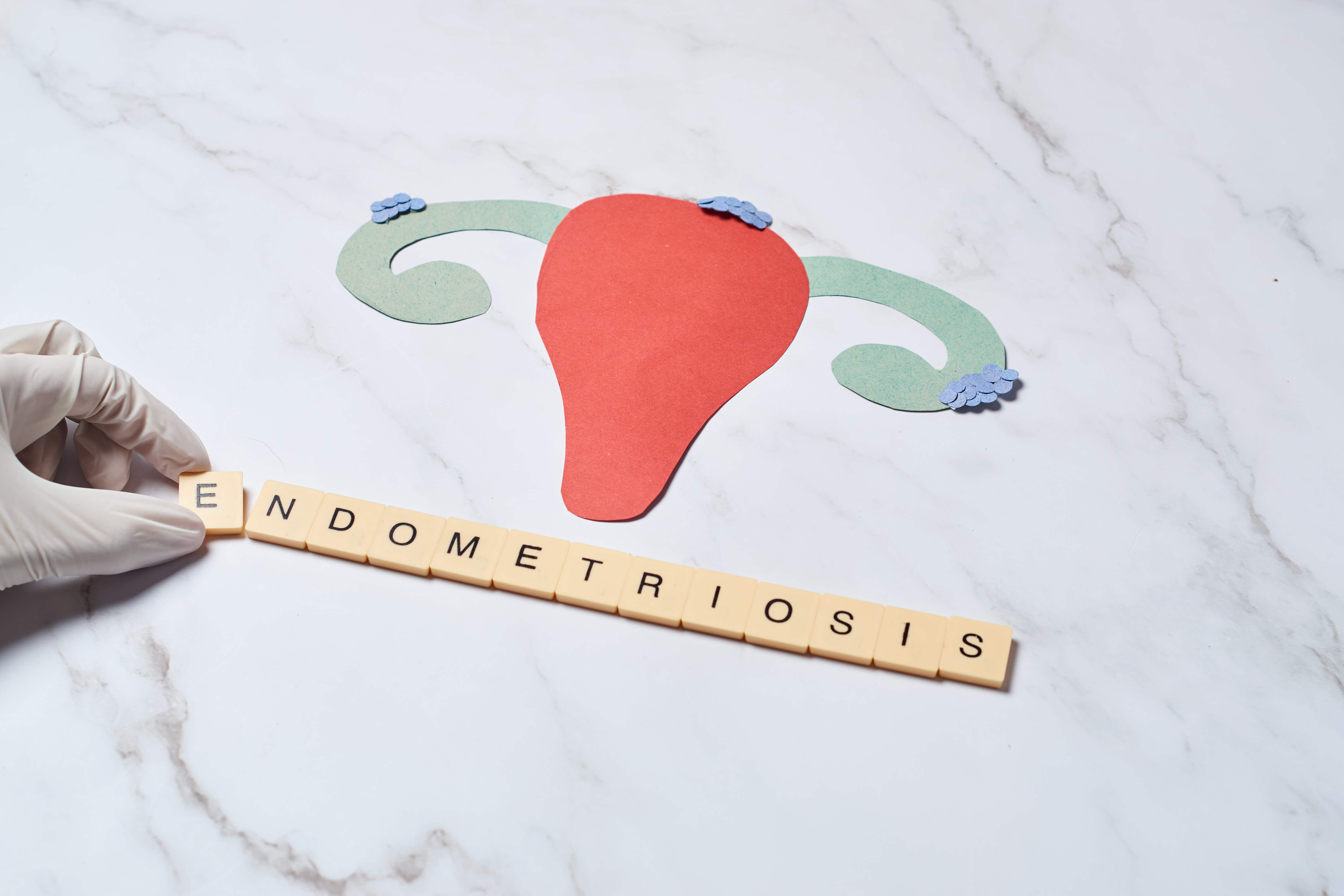 Endometriosis Awareness: Why “Period Pain” Shouldn’t Be Dismissed