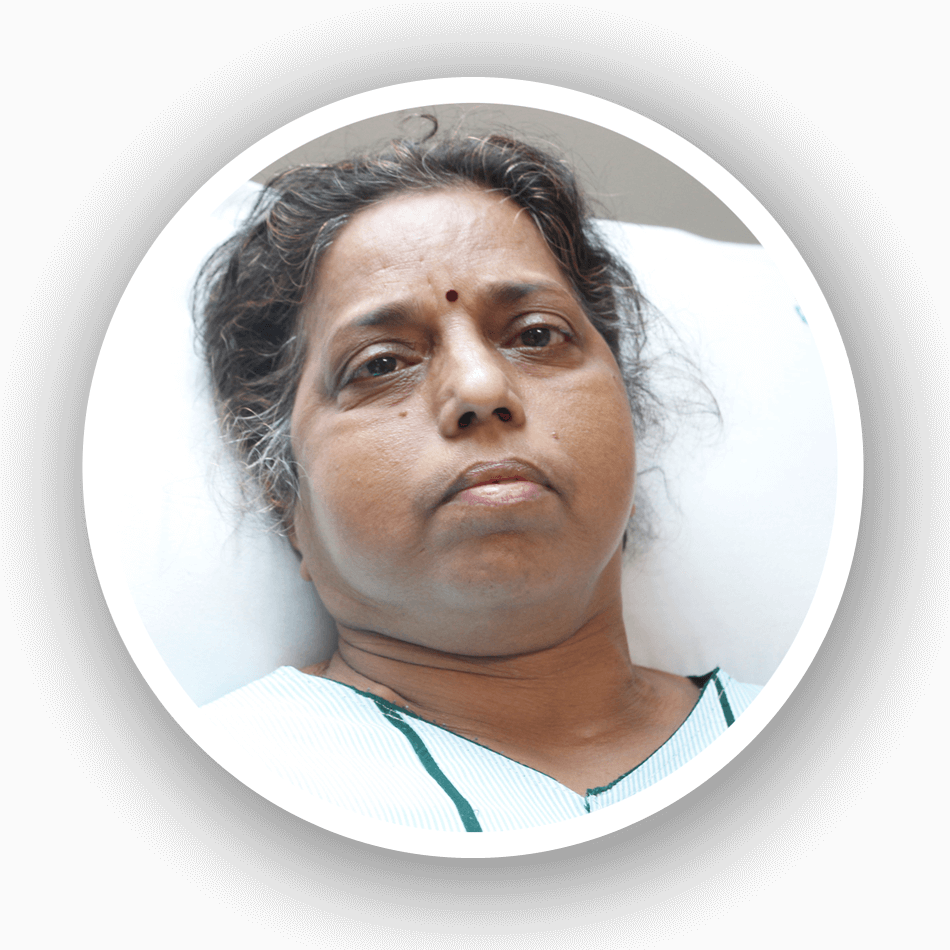 crowdfunding in kidney transplant